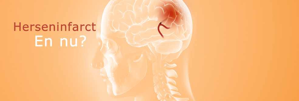 herseninfarct kenmerken symptomen oorzaak gevolgen behandeling
